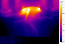 Bipolar RF Thermal Image