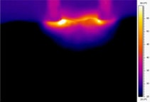 Bipolar RF Thermal Image